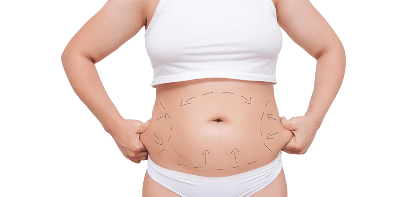 mini-abdominoplasty-tt