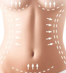 abdominoplastie-tunisie-271×300.jpg