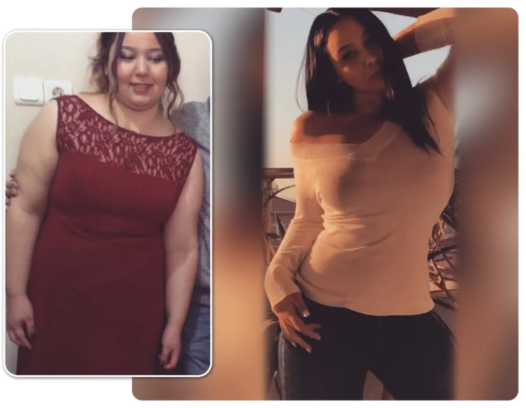 before-after-sablonu-2-copy-768×596-1