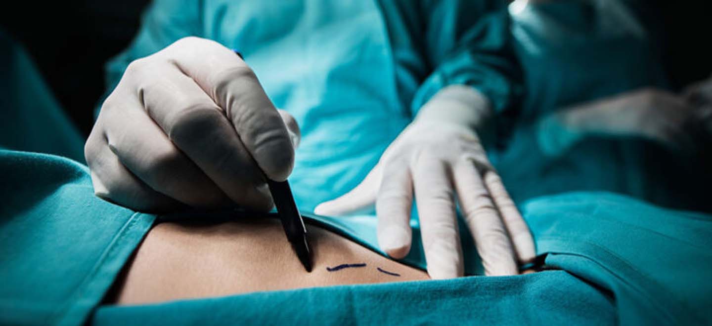 chirurgie-plastique-reconstructrice-esthetique
